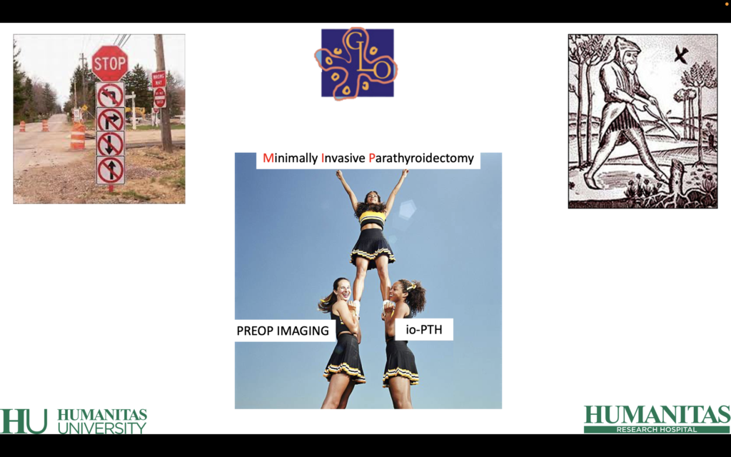 Minimally Invasive Parathyroidectomy Paratiroidectomia mini-invasiva Giuseppe Mercante Otorinolaringoiatria Tiroide Ghaindole paratiroidi iperparatiroidismo primario primary hyperparathyroidism